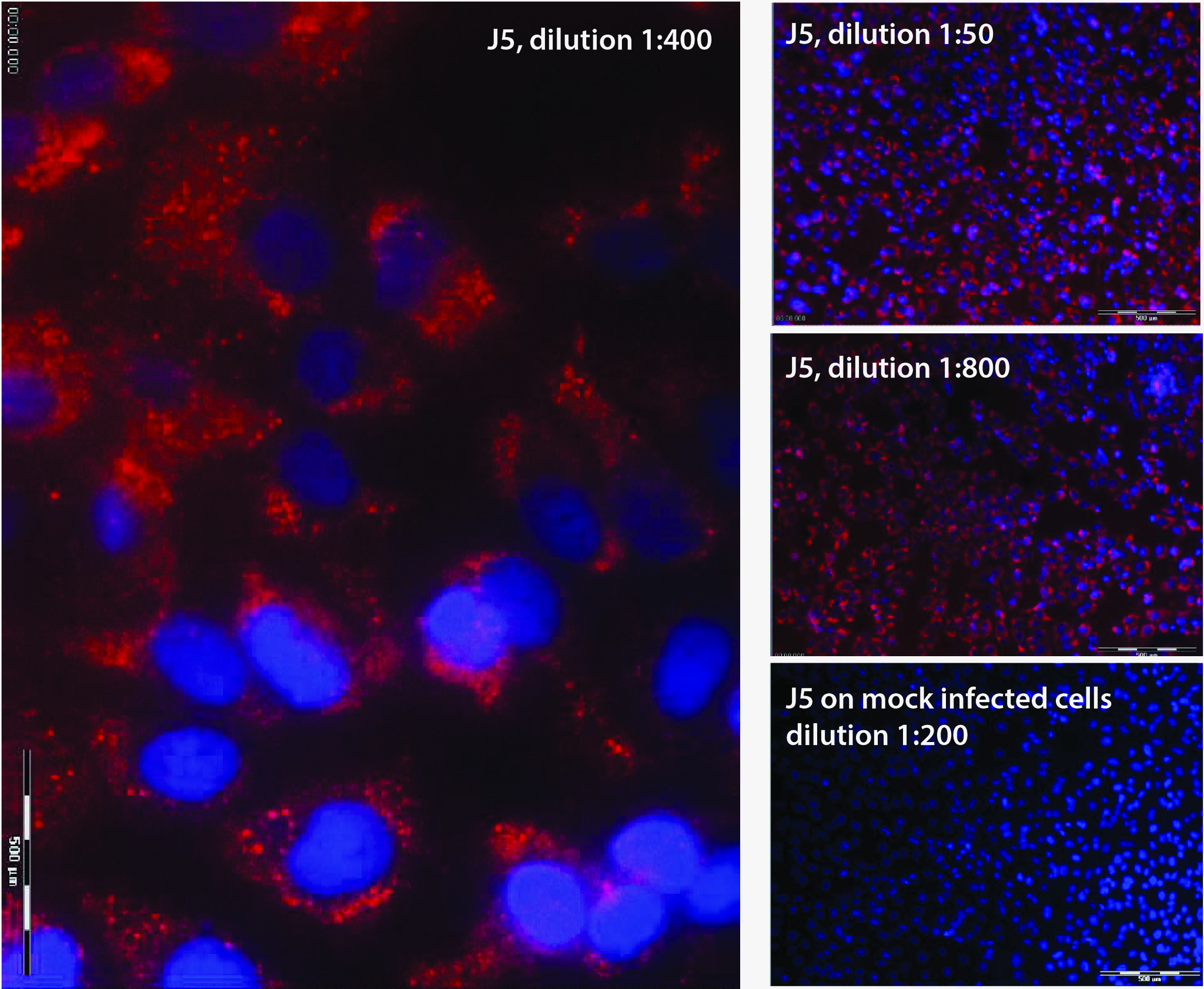 Figure 1. J5 detects dsRNA in Vero cells infected with ECMV. dsRNA is visualized with different dilutions of J5 and is not detectable in mock infected cells. Cells were fixed with 3% PFA for 30min at 2-8°C, permeabilized with 0.5% Triton-X 100 for 5min at room temperature and J5 was detected with Cy3-labelled goat anti-mouse secondary antibody. red: dsRNA, blue: DAPI nuclear stain. Images courtesy of Friedemann Weber, Justus-Liebig-University Giessen, Germany.